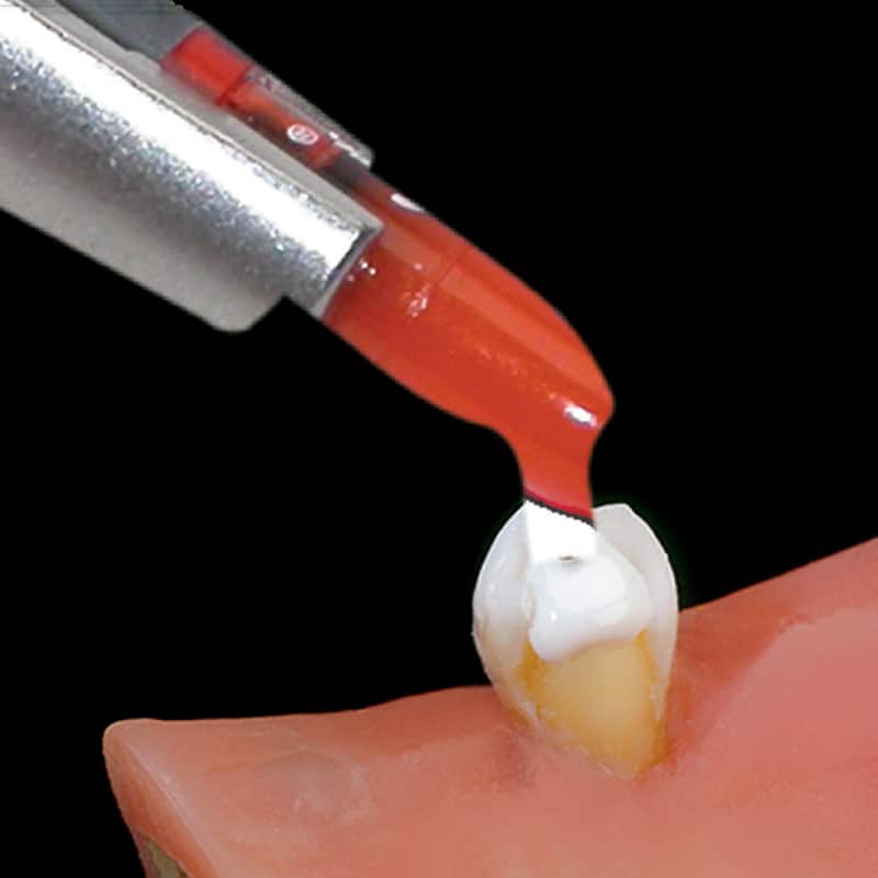 SuperCure being used in a dental procedure